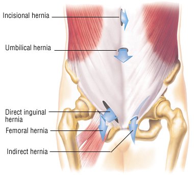 Where is the groin area?