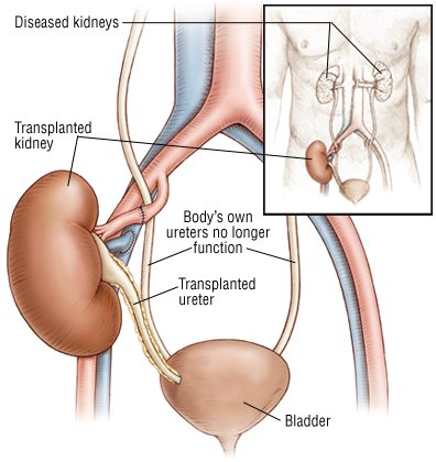 And tramadol transplant kidney