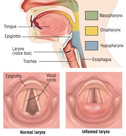 Throat Hurts When Coughing 101