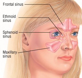 Ocular hypertension (high eye pressure) causes and treatments