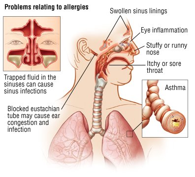 Dry Throat Stuffy Runny Nose 103