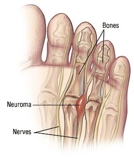 What are some causes of numbness in your big toe?
