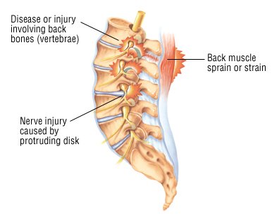 What illnesses can cause pain in the right side?