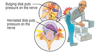 What illnesses can cause pain in the right side?