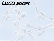 Candidiasis Guide Causes Symptoms And Treatment Options