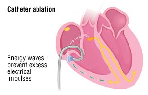 5 htp and gabapentin