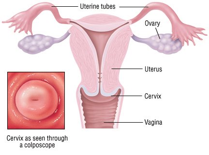 Cervical Polyps