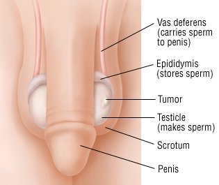 How do you know your testosterone level