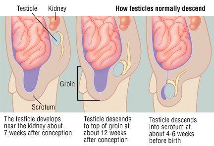 What causes testicular hernia pain?