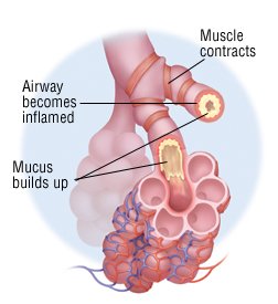 Chronic Obstructive Pulmonary Disease (COPD) Guide: Causes ...