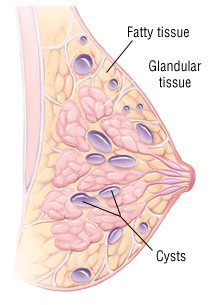 What are some treatment options for synovial cyst knee problems?