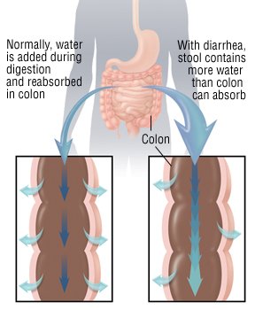 Common causes of dog diarrhea   selfgrowth.com