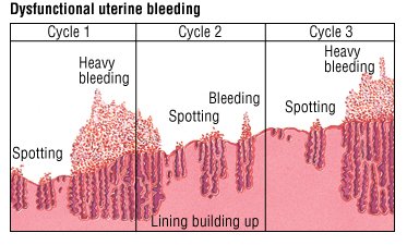 heavy bleeding in between periods