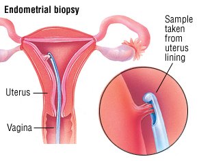 abnormal period spotting