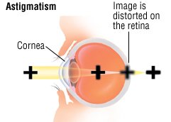 How do you correct double vision?