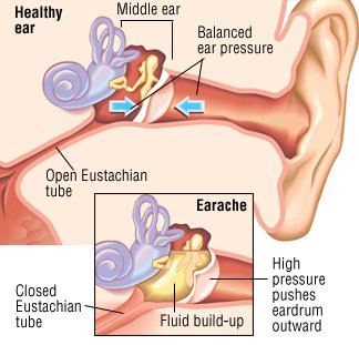 Can i take tramadol for earache