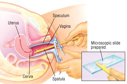 Vaginal Discharge Guide Causes Symptoms And Treatment Options