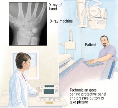 X-Rays Guide | Drugs.com