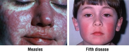 On can xanax face help skin rashes