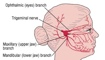 Trigeminal Neuralgia (Tic Douloureux)