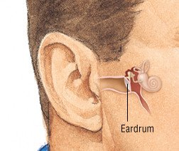 Luftfart Oberst session Perforated Eardrum Guide: Causes, Symptoms and Treatment Options