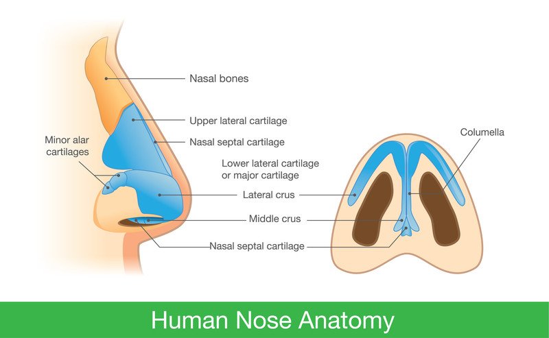 Nosebleed (epistaxis)