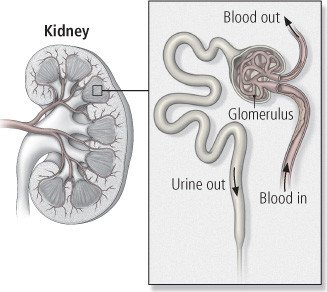 Diabetic nephropathy