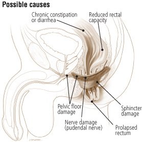 sex Multiple sclerosis painful