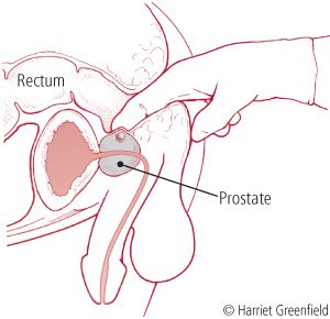 Anal leakage in puppy