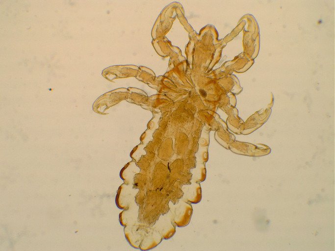 Head louse clinging onto strands of human hair SEM  Wellcome Collection