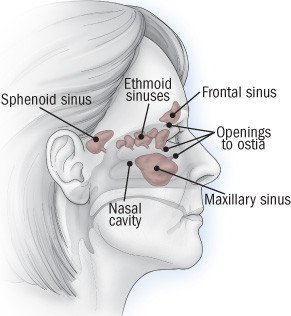 Sinus: Causes & Symptoms