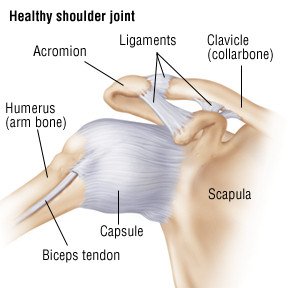 Fracture de l'épaule