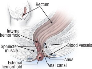 Bleed From Ass