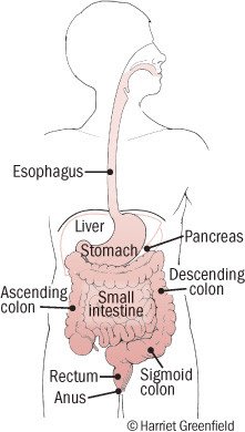 Peptic Ulcer