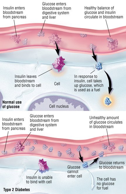 [Possible explanation of the hemoglobin glycation index by the biokinetic model of glycation]