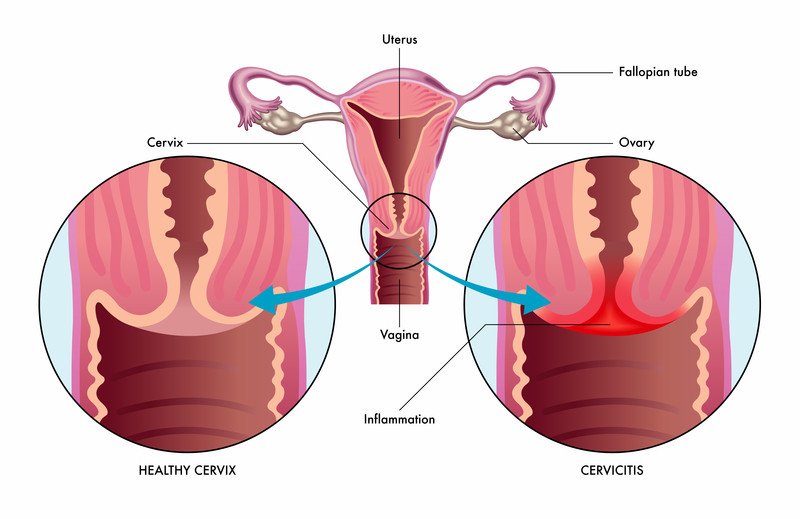 Vagina Swollen After Sex