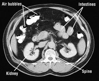 Computed tomography (CT)