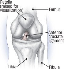 ACL (Anterior Cruciate Ligament) Injuries