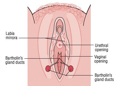 Labia majora on cysts Vulvar epidermoid