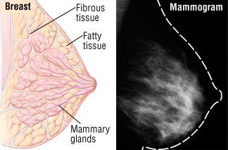 Mammography