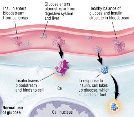 insulin dependent diabetes mellitus type 1)