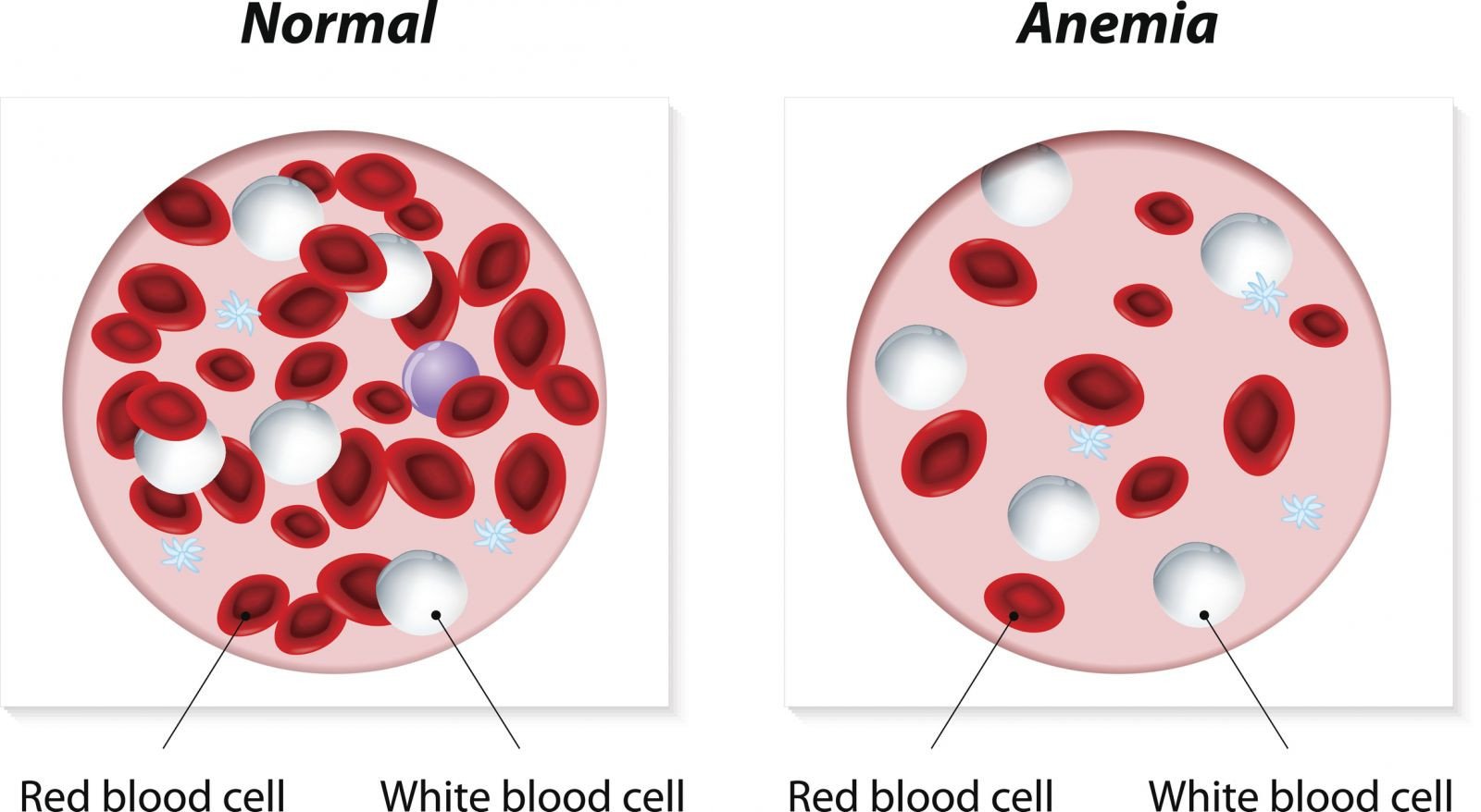 How low can hemoglobin go before death