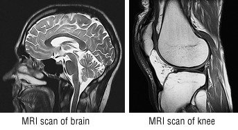 Magnetic resonance imaging (MRI)