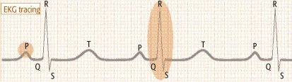 Electrocardiogram (EKG)