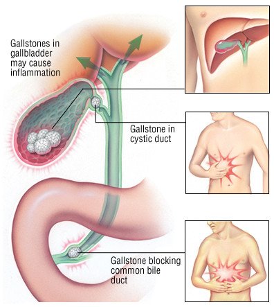 Gallbladder