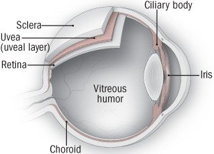 Uveitis