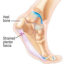 sudden sharp shooting pain in heel