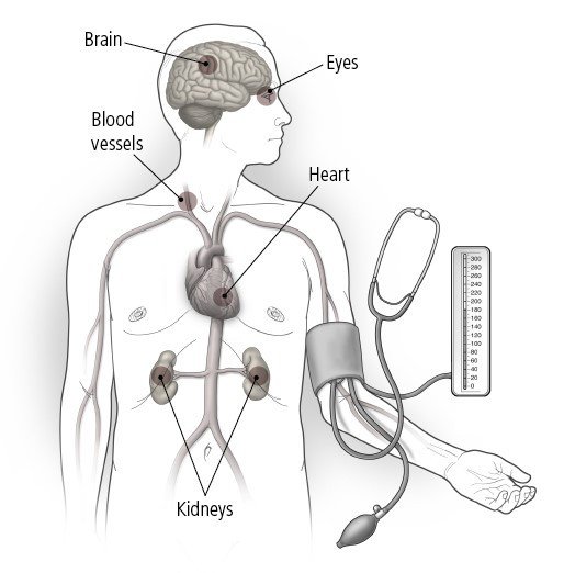 High Blood Pressure and Women - Go Red for Women