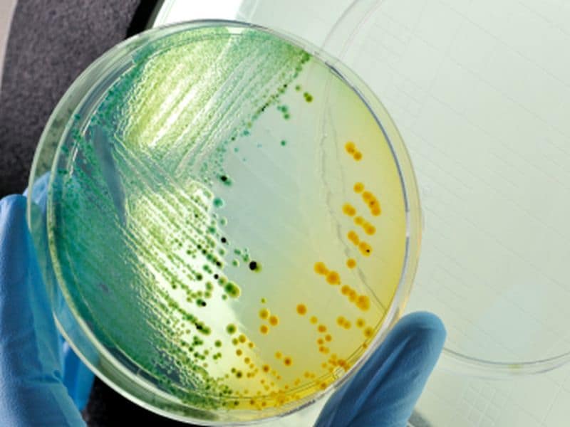 icd 10 code for methicillin resistant staphylococcus aureus infection unspecified site