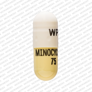 Minocycline hydrochloride 75 mg WPI MINOCYCLINE 75 Front